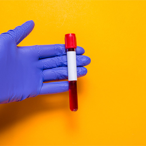 Anemia-2
